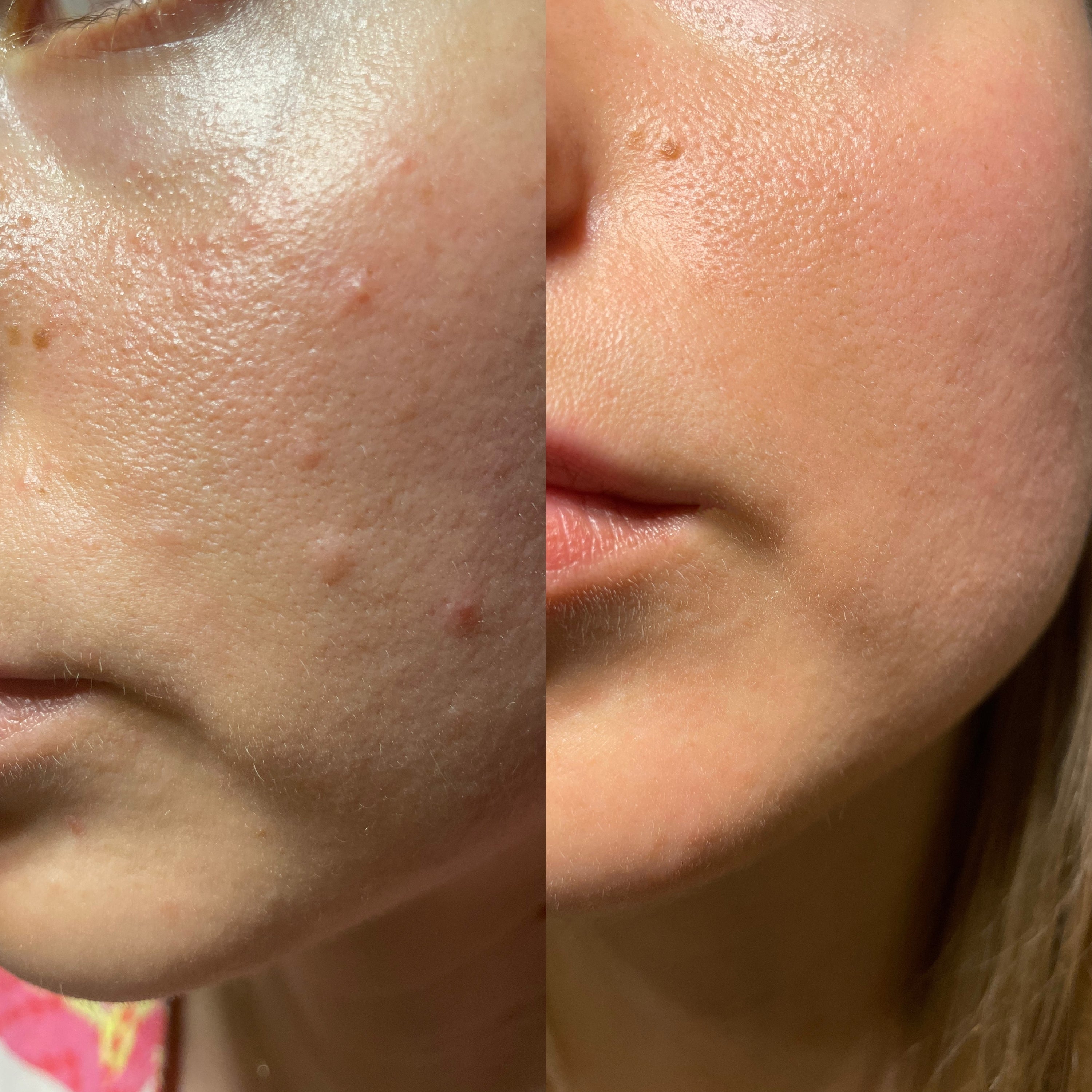 Collagen Pearls