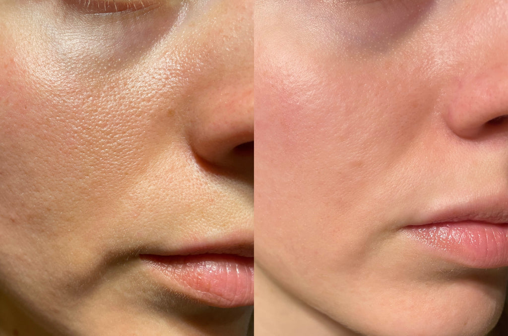 Collagen Pearls