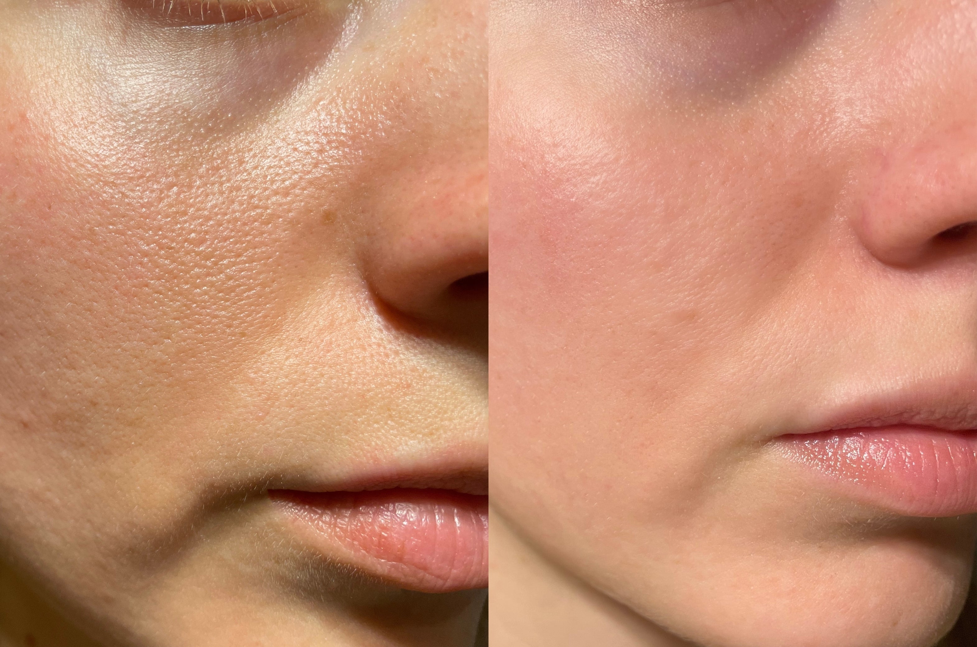 Collagen Pearls