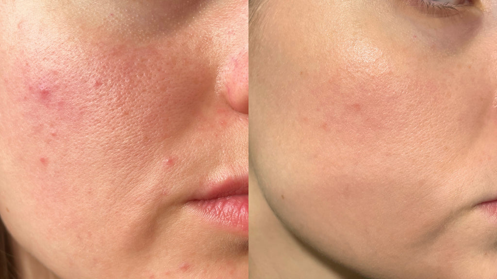 Collagen Pearls