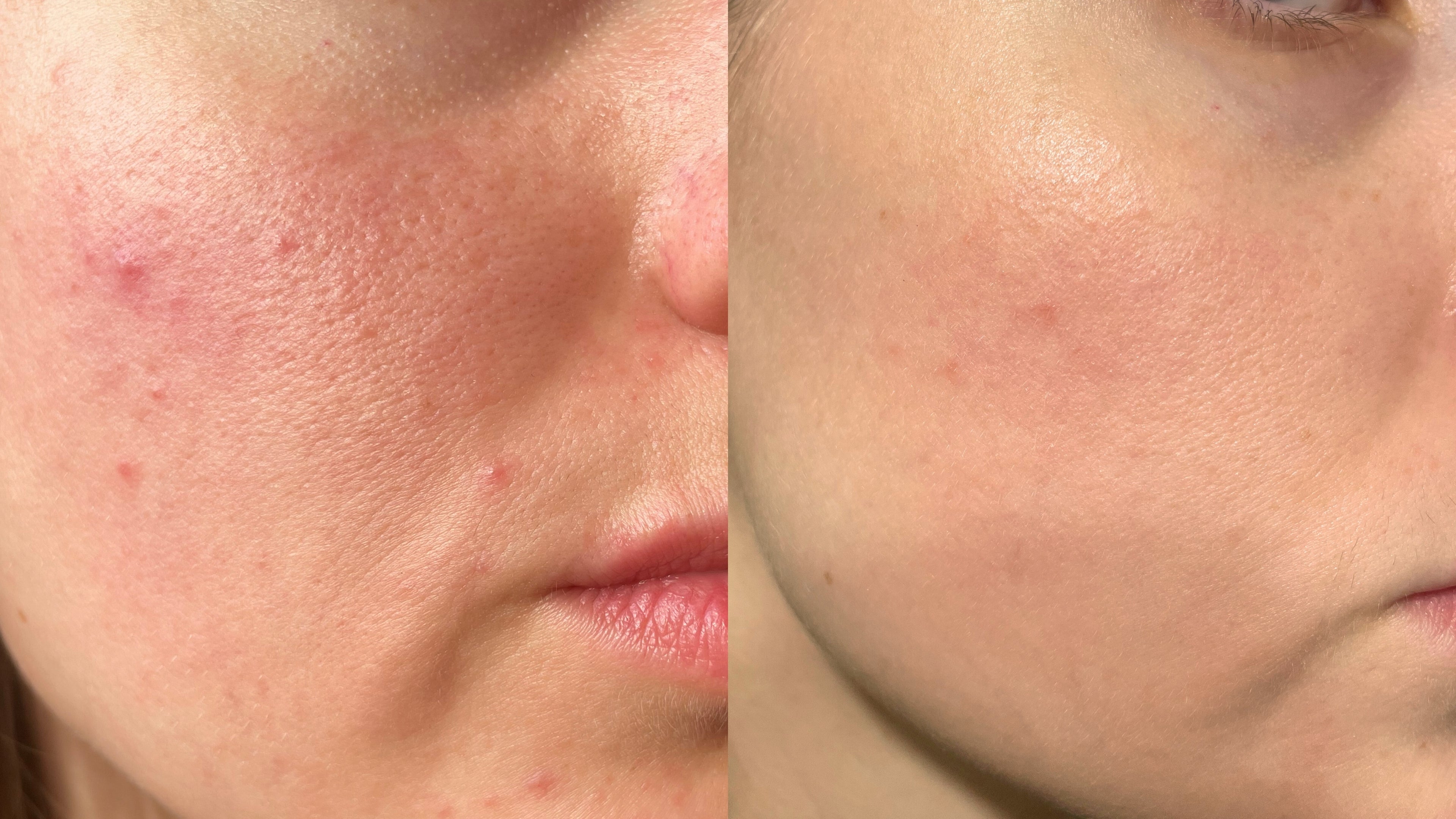 Collagen Pearls